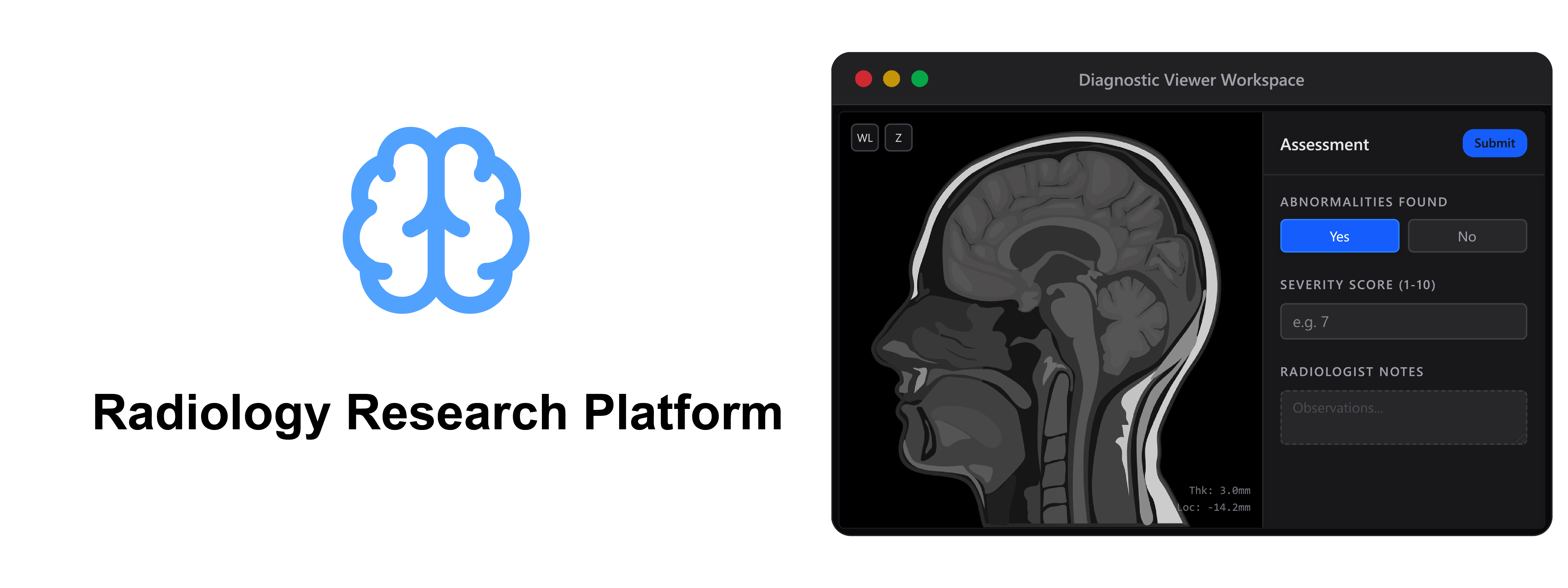 Radiology Research Platform Web-based radiology research workspace with OHIF v3 DICOM viewing and structured assessments.