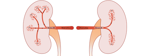 To date, there is no unified approach to the lobar, zonal, and segmental structure of the kidney vasculature. There is no recognizable approach to define basic characteristics in regard to the lobes and segments identifying of the kidney. The branching of the renal artery has often been the subject of scientific research. This study aimed to analyze the arterial anatomy on the basis of zonal and segmental topography. This study is a prospective cadaver study on autopsy material using corrosion casting and CT imaging techniques. The arterial vasculature was visualized using corrosive casting. In this study, 116 vascular casts were included. We identified the number of arteries in the kidney hilum, their topography, branching variations of the renal artery, and local blood supply zones of renal masses considering second- and third-order renal artery branches. We used a micro-CT BRUKER SkyScan 1178, digital camera, Mimics-8.1, and R. This study has shown that RA divides into two or three zonal arteries, forming a two- or three-zonal vascular supply system. In the case of the two-zonal system, 54.3% of cases accounted for RA branching into ventral and dorsal arteries, whereas 15.5% of cases referred to superior polar and inferior polar zonal arteries. The three-zonal system implies 4 types of RA branching: 1) superior polar, ventral, and dorsal zonal branches (12.9%); 2) ventral, dorsal, and inferior polar zonal branches (9.5%); 3) two ventral and one dorsal zonal branches (5.2%), and 4) superior polar, central, and inferior polar zonal branches (2.5%). The results of this research make us reconsider Graves' classification theory.